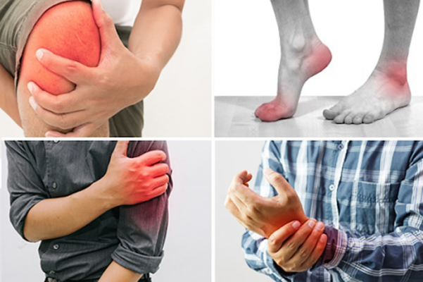 Một số triệu chứng thường gặp của bệnh viêm khớp