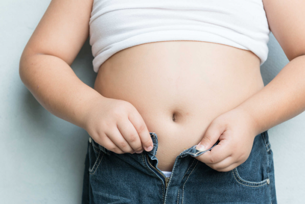 Thừa cân béo phì là nguyên nhân gây đau nhức xương khớp thường gặp nhất ở người những trẻ
