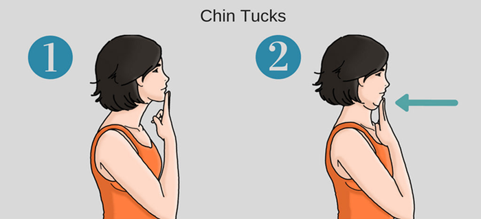 Bài tập 1 – Chin Tucks.