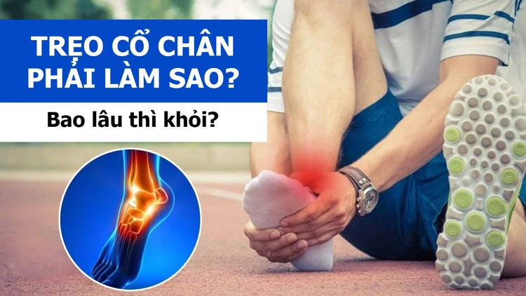 Bị trẹo chân